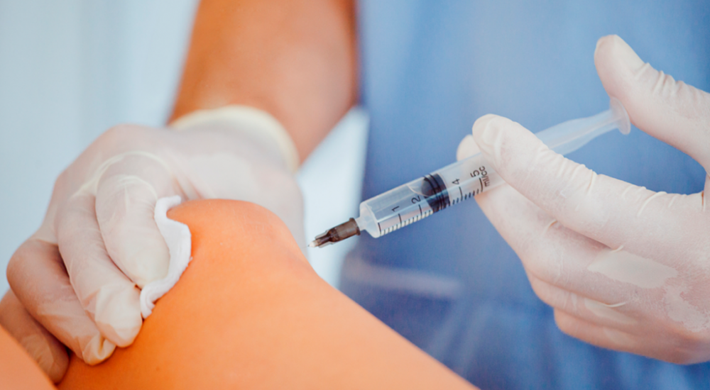 Escleroterapia-1-1024x574 Escleroterapia-1-1024x574