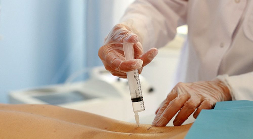 Tratamiento-de-ozono2 Tratamiento-de-ozono2