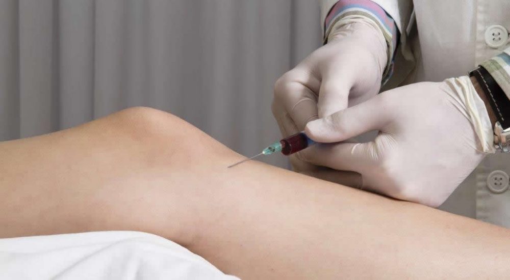 kolano-prp kolano-prp